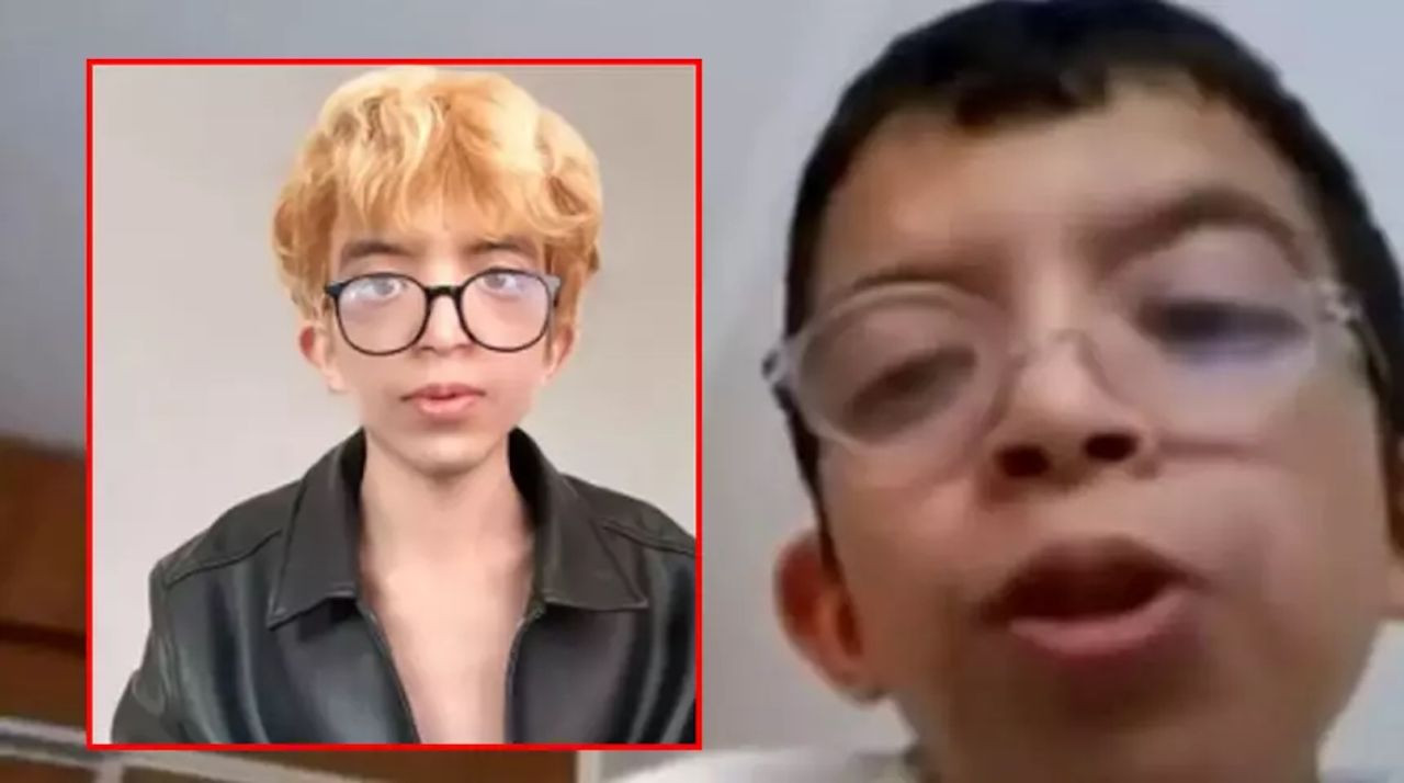 Sosyal medyada zorbalık, 5 yüz ameliyatı: Tablet Reis’in ağlatan değişim hikayesi - Resim: 1