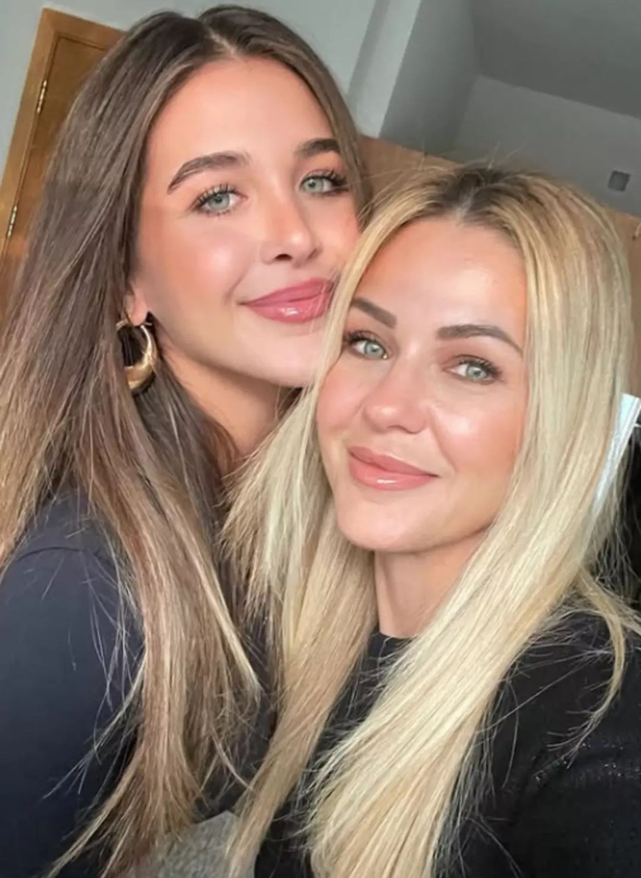 48 yaşındaki Emine Ün'den estetik itirafı: Karşı değilim - Resim: 4