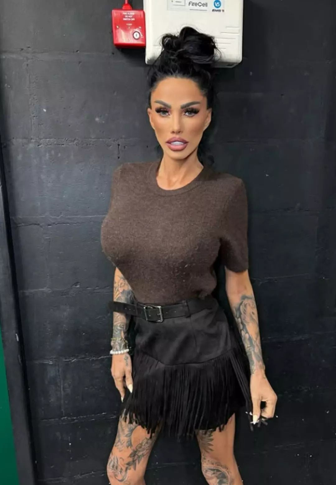 Türkiye’de estetik yaptırmıştı! Katie Price hastanelik oldu, son hali şaşırttı - Resim: 3