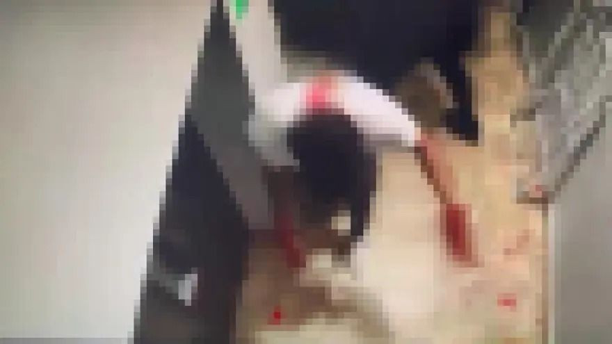 Boşanma aşamasındaki eşine otelde bıçaklı saldırı: 2 yaralı - Resim: 5