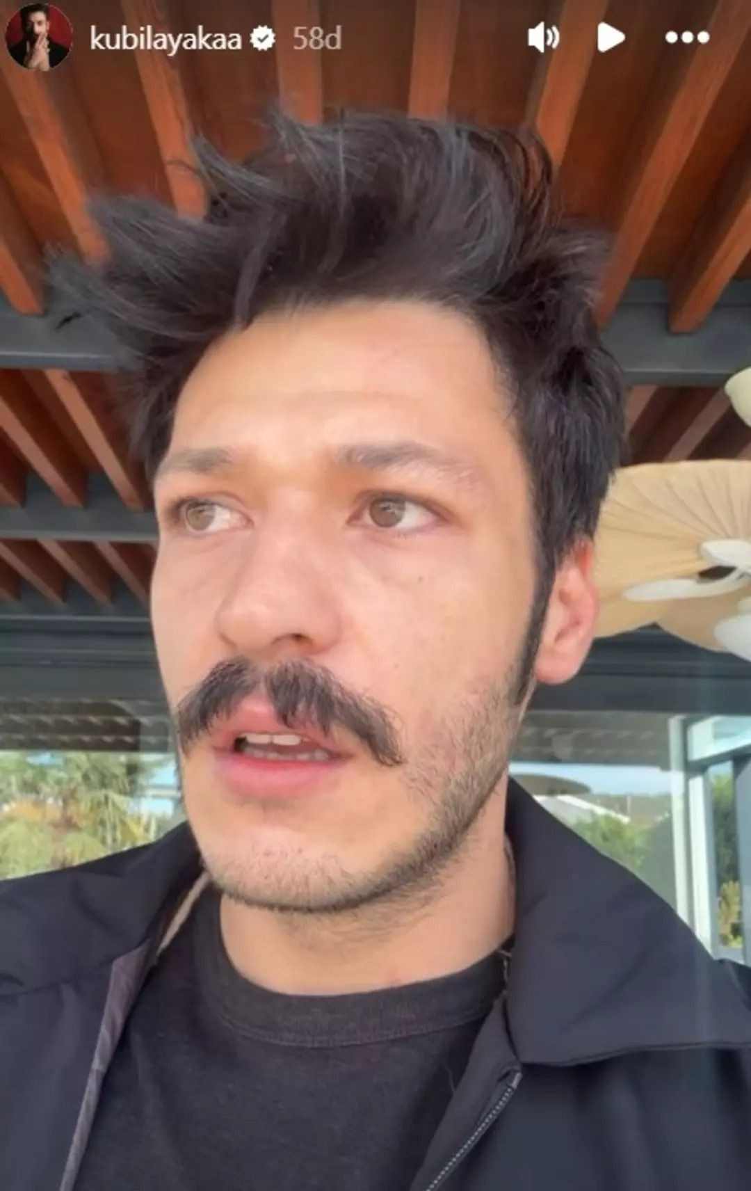 Ünlü oyuncu Kubilay Aka kedilere kurulan kapanları gösterdi, jandarma devreye girdi - Resim: 4