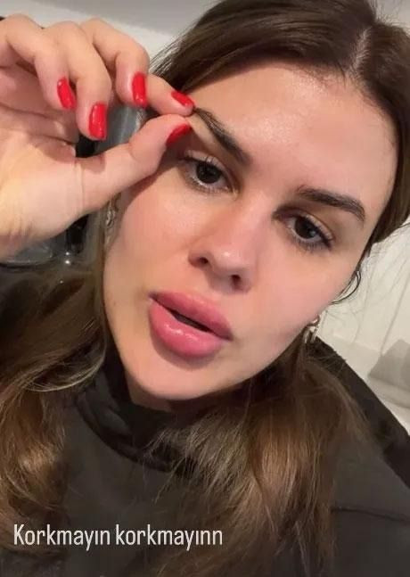 Şovmen Mehmet Ali Erbil’in eşi Gülseren Ceylan göz kapaklarını aldırdı - Resim: 4