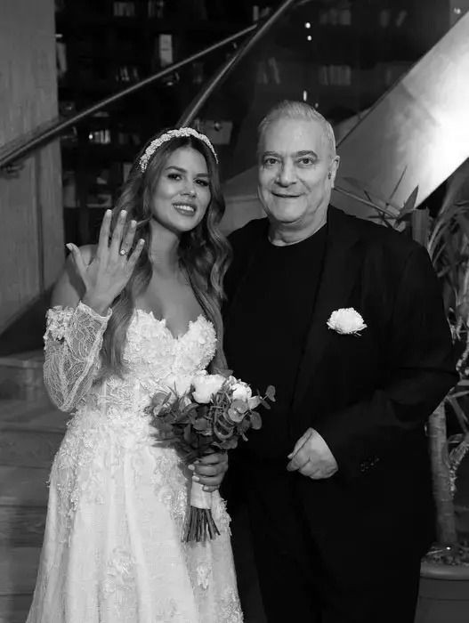 Şovmen Mehmet Ali Erbil’in eşi Gülseren Ceylan göz kapaklarını aldırdı - Resim: 2