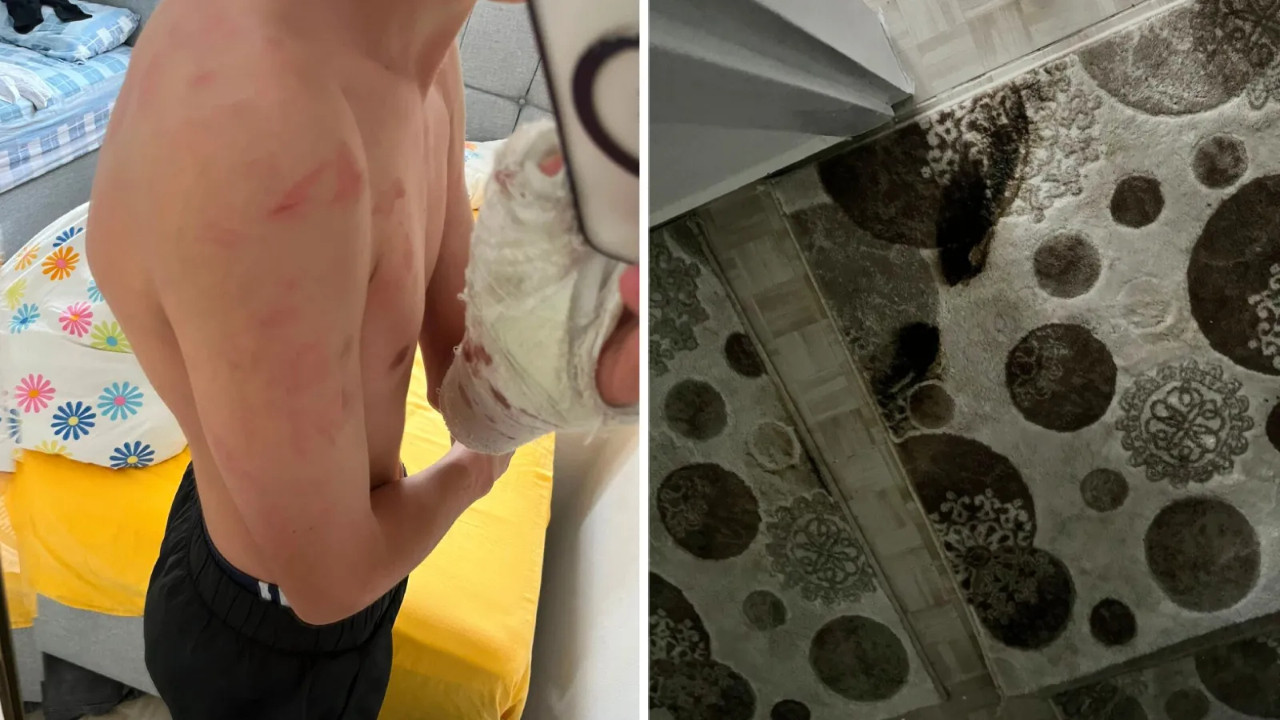İddia: Polisler‘yanlış adrese’baskın yaptı; aile darbedildi, 15 yaşındaki çocuğun kolu kırıldı